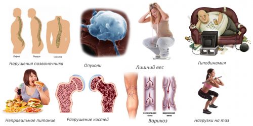 Коксартроза: класификация, симптоми и лечение