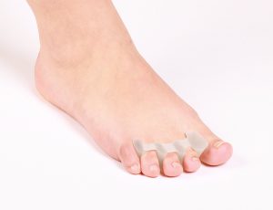 Изкривяване на големи и други пръсти на краката