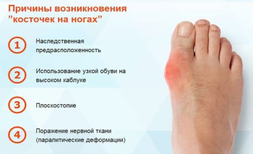 Характеристики на домашното кост лечение на големия пръст