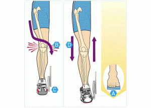 Характеристики на проявление на деформация на ставите на колянните стави