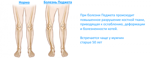 Характеристики на проявление на деформация на ставите на колянните стави
