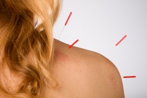 Характеристики на изпълнение на масаж при периартрит на рамото