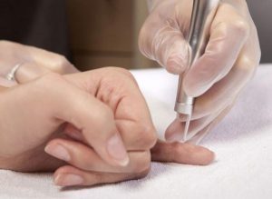 Характеристики на лечение на удари по ставите на пръстите