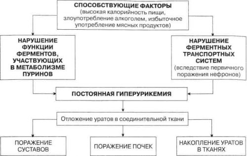 Подагра: каква е класификацията на етапите и формите