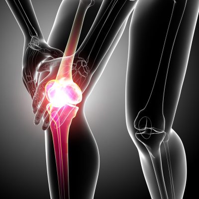Болка и хрускам в колянната става: причини и какво да лекуваме?