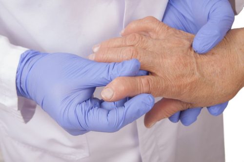 Симптоми и начини за лечение на подагра на пръстите