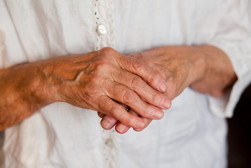 Лечение на ревматоиден артрит на пръстите и ръцете, първите симптоми
