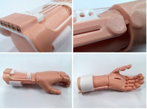 Видове продукти за протезиране на ръката