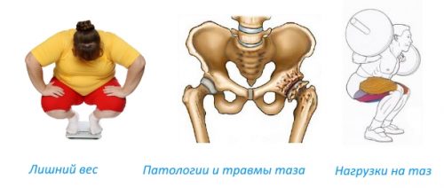 Какво представлява остеосклерозата и как да се лекува утъпкването на костите?