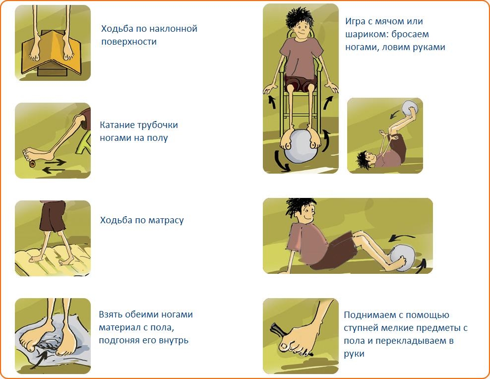 Ефективни методи за предотвратяване на плоски крака