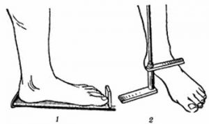 Методи за определяне на плоски крака при деца и възрастни