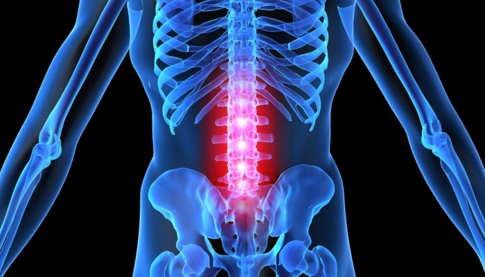 Комплекс от упражнения за остеохондроза на лумбалния гръбначен стълб