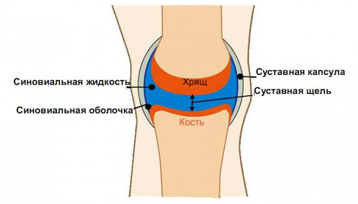Как да се лекува артроза на колянната става? лечение