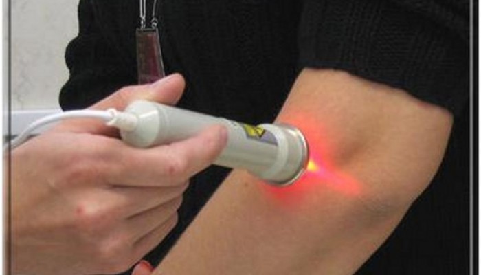 Лечение на ставите чрез лазер: физиотерапия