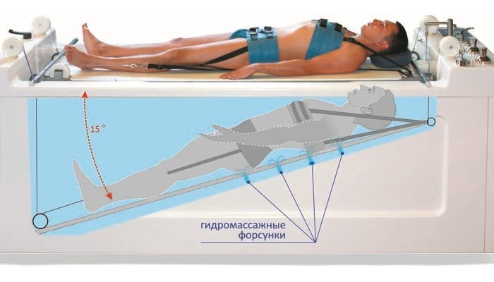 Подводно разширение на гръбнака с херния: индикации, противопоказания, ефикасност