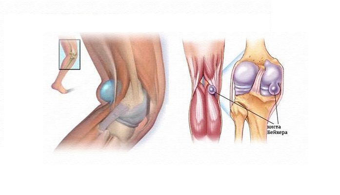 Какви са операциите по колянната става?