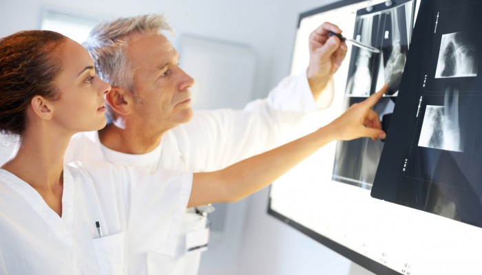 Какво показва рентгеновото изображение на гръбначния стълб?