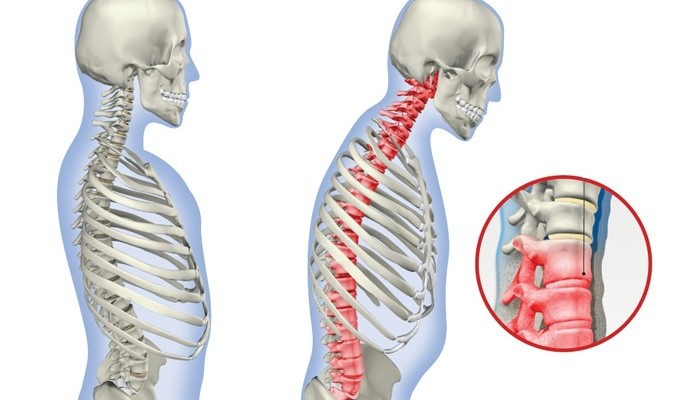 Какво показва рентгеновото изображение на гръбначния стълб?