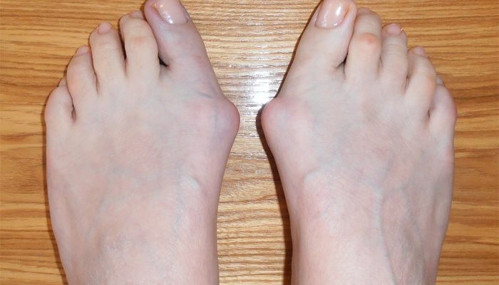 Превръзка за пръстите на краката: доказателства и характеристики