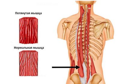 Причини за болка в долната част на гърба и краката