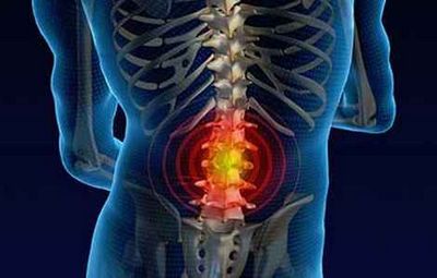 Средства за болки в гърба в долната част на гърба