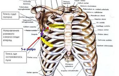 Болка от гърба под ребрата