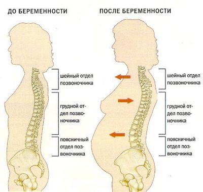 Болка от страна на гърба по време на бременност