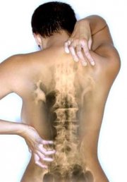 Упражнения за остеохондроза на цервикален и гръден кош