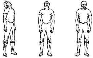 Упражнения за остеохондроза на цервикален и гръден кош