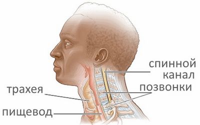 Остеохондроза на цервикалната област и бучка в гърлото