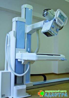 Рентгеново изследване на цервикалния гръбначен стълб