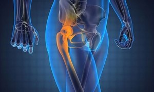 Кракът боли от коляно до бедро: поради факторите, които възникват и как да се премахне дискомфорта