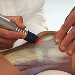 Физиотерапия с артроза на колянната става (физиотерапия, физиотерапия, ултразвук, електрофореза)