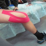Какво е teiping: спортно оборудване за рамото и коляното