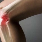 Народно лекарство за болка в ставите на коляното