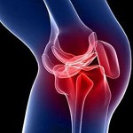 Хирургия на колянните стави: упражнения за рехабилитация на коляното