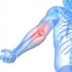 Мехлем от ставна артроза (коляно, рамо, стъпало): преглед на препаратите