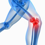 Операция с артроза на колянната става: третиране с 3 и 4 градуса