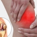 Болки за артрит: лечение на възпаление на ставите с инжекции