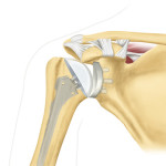 Хирургия на раменната става: хирургично лечение на рамото (артроскопия)