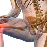 Лечение на артроза на колянната става с желатин: прегледи