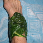 Лечение със зелеви листа: компреси за връзките на зеле