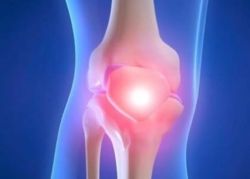 Osteomed: нова дума при лечението на остеоартрит и остеопороза *
