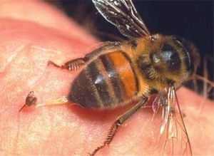 Мази Апазархрон - пчели за предпазване на здравето на вашите стави