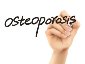 Алендронова киселина - необходимо вещество за лечение на остеопороза