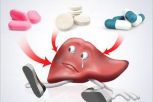 Нестероидни противовъзпалителни средства за лечение на стави: класификация, списък