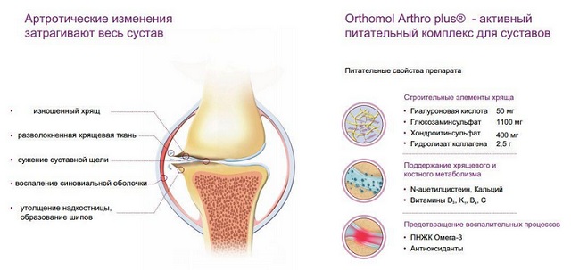Orthomol Arthro Plus - витаминозен комплекс за възстановяване на ставната функция