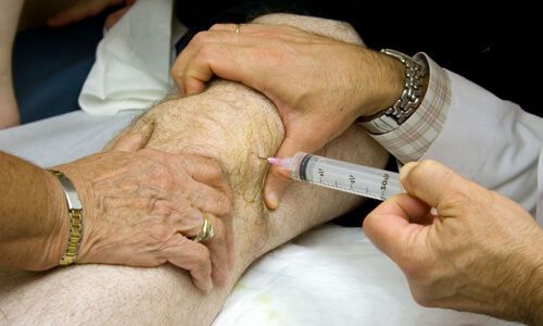 Инжектиране на хиалуронова киселина в коляното