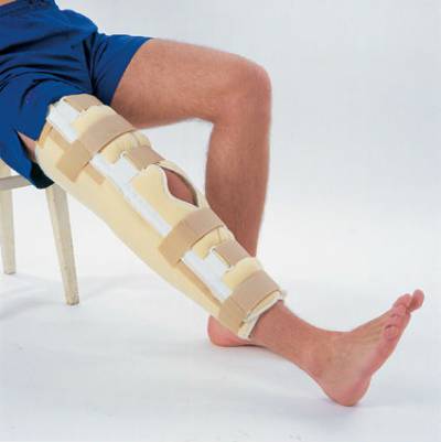 Как да изберем добра бандаж за коляното?