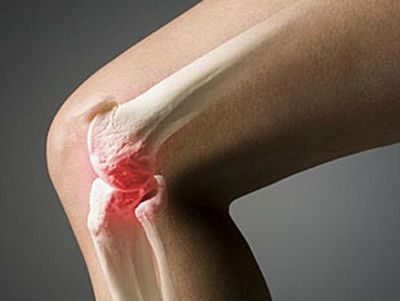 Какво трябва да бъде диетата за остеоартроза на коляното?